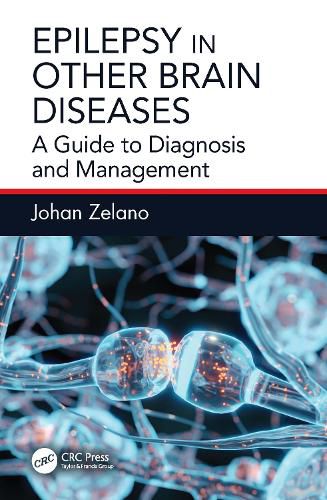 Cover image for Epilepsy in Other Brain Diseases