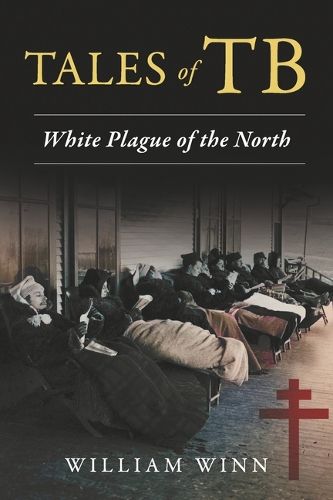 Cover image for Tales of Tb