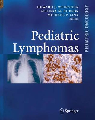 Cover image for Pediatric Lymphomas