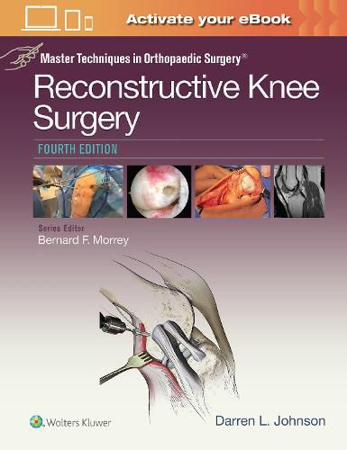 Cover image for Master Techniques in Orthopaedic Surgery: Reconstructive Knee Surgery