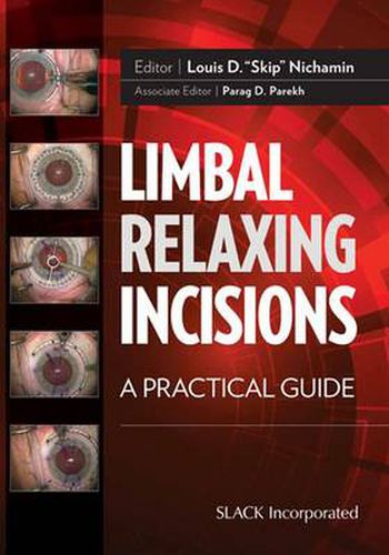 Cover image for Limbal Relaxing Incisions: A Practical Guide