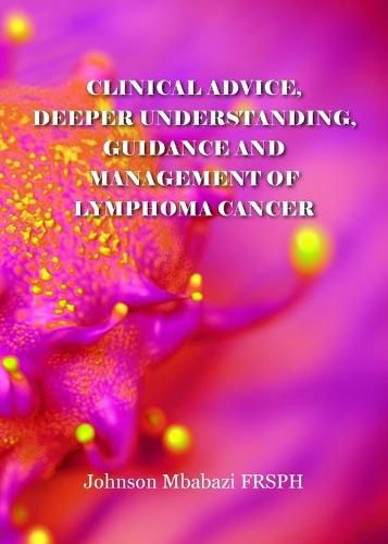 Cover image for Clinical advice, deeper understanding, guidance and management of lymphoma cancer