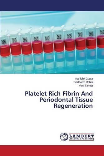 Cover image for Platelet Rich Fibrin And Periodontal Tissue Regeneration