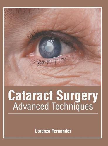 Cover image for Cataract Surgery: Advanced Techniques