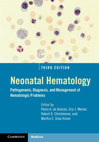 Cover image for Neonatal Hematology: Pathogenesis, Diagnosis, and Management of Hematologic Problems