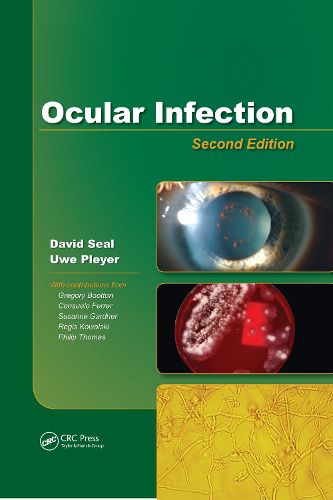 Cover image for Ocular Infection: Investigation and Treatment in Practice