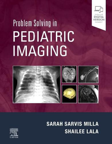 Cover image for Problem Solving in Pediatric Imaging