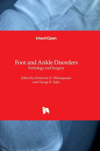 Cover image for Foot and Ankle Disorders