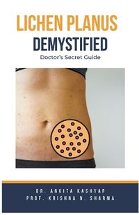 Cover image for Lichen Planus Demystified Doctors Secret Guide