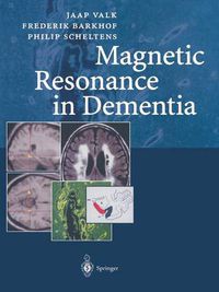 Cover image for Magnetic Resonance in Dementia