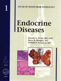 Cover image for Endocrine Diseases