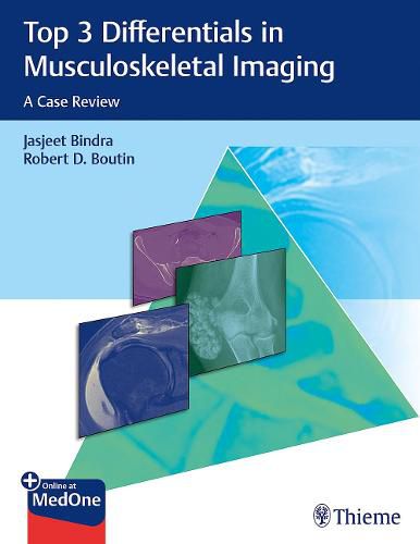 Top 3 Differentials in Musculoskeletal Imaging: A Case Review