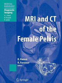 Cover image for MRI and CT of the Female Pelvis