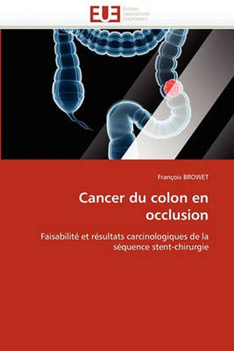 Cover image for Cancer Du Colon En Occlusion