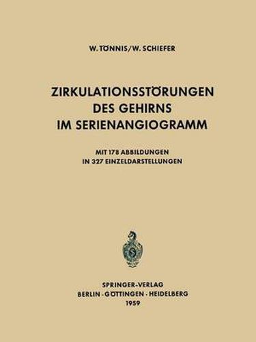 Cover image for Zirkulationsstoerungen des Gehirns im Serienangiogramm