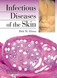 Cover image for Infectious Diseases of the Skin