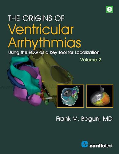 The Origins of Ventricular Arrhythmias, Volume 2: Using the ECG as a Key Tool for Localization, Volume 2