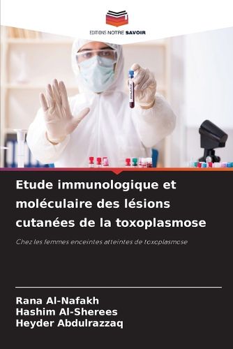 Cover image for Etude immunologique et moleculaire des lesions cutanees de la toxoplasmose