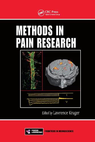 Cover image for Methods in Pain Research