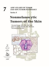 Cover image for Nonmelanocytic Tumors of the Skin