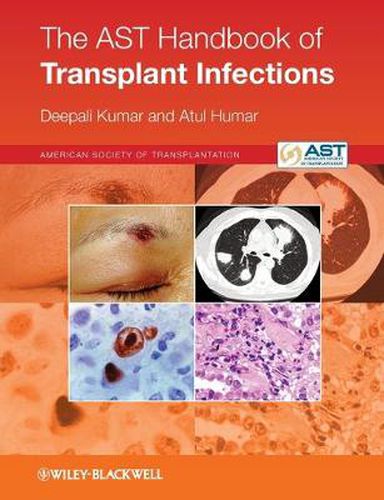 Cover image for The AST Handbook of Transplant Infections