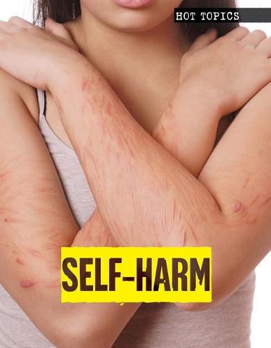 Cover image for Self-Harm