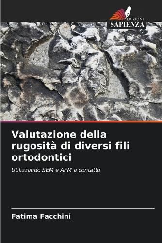 Cover image for Valutazione della rugosita di diversi fili ortodontici