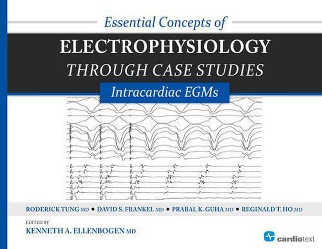 Essential Concepts of Electrophysiology Through Case Studies: Intracardiac EGMs: Intracardiac EGMs