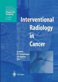 Cover image for Interventional Radiology in Cancer