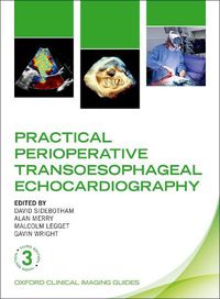 Cover image for Practical Perioperative Transoesophageal Echocardiography