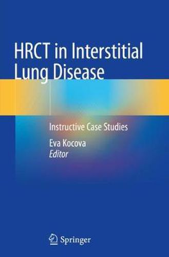 Cover image for HRCT in Interstitial Lung Disease: Instructive Case Studies