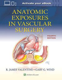Cover image for Anatomic Exposures in Vascular Surgery