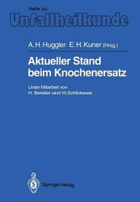 Cover image for Aktueller Stand Beim Knochenersatz