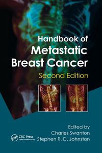 Cover image for Handbook of Metastatic Breast Cancer