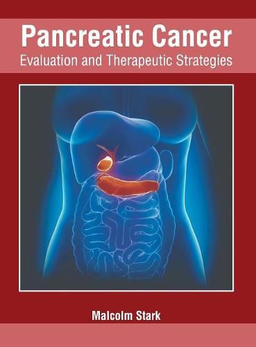 Cover image for Pancreatic Cancer: Evaluation and Therapeutic Strategies