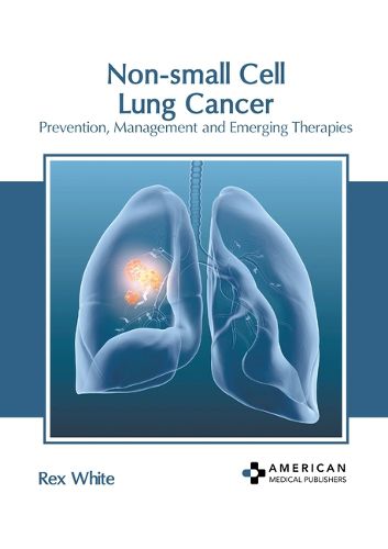 Cover image for Non-Small Cell Lung Cancer: Prevention, Management and Emerging Therapies