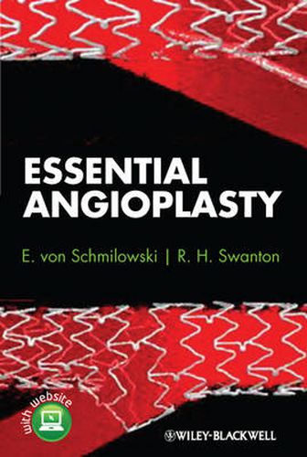 Cover image for Essential Angioplasty