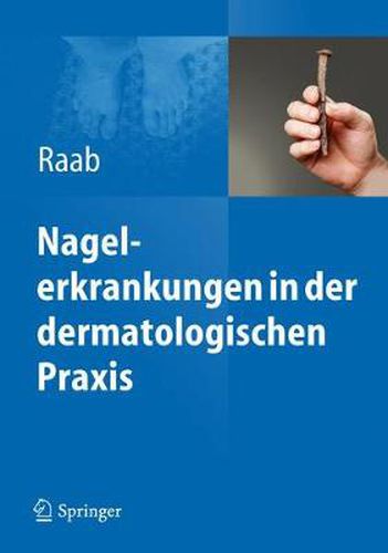 Cover image for Nagelerkrankungen in der dermatologischen Praxis