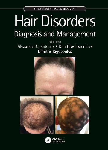 Hair Disorders: Diagnosis and Management