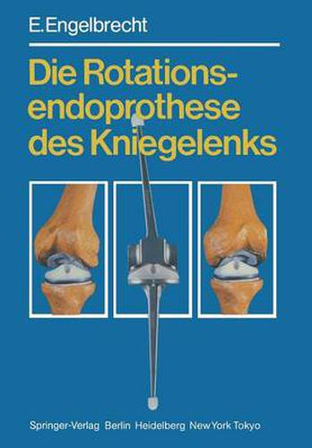Cover image for Die Rotationsendoprothese des Kniegelenks