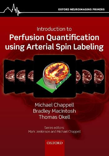 Introduction to Perfusion Quantification using Arterial Spin Labelling