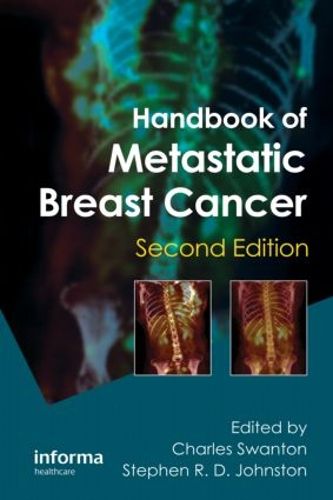 Cover image for Handbook of Metastatic Breast Cancer