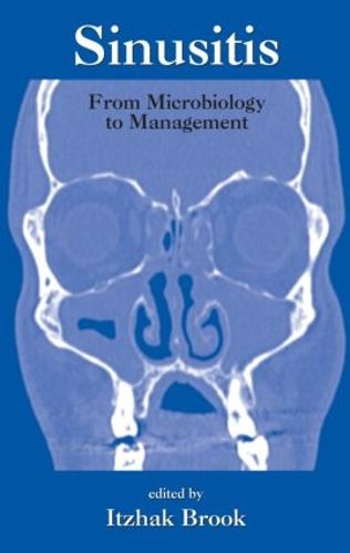 Cover image for Sinusitis: From Microbiology To Management