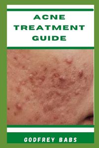 Cover image for Acne Treatment Guide
