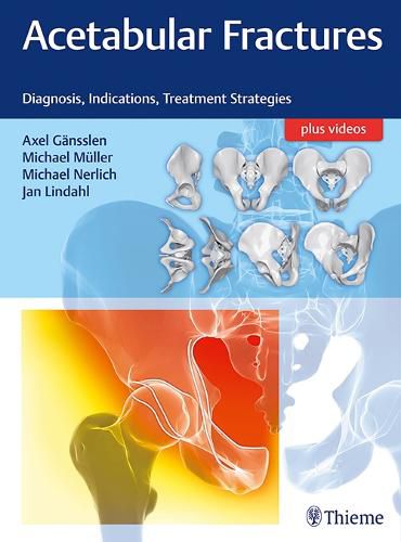 Cover image for Acetabular Fractures: Diagnosis, Indications, Treatment Strategies