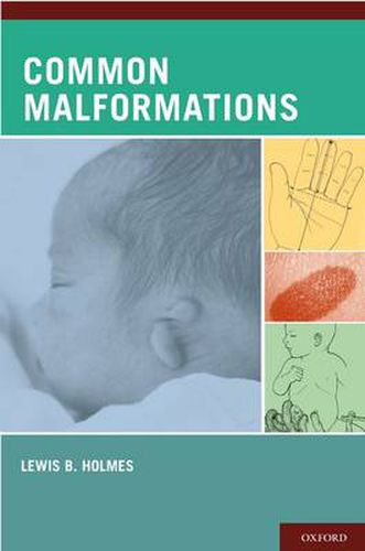 Cover image for Common Malformations