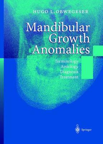 Cover image for Mandibular Growth Anomalies: Terminology - Aetiology Diagnosis - Treatment