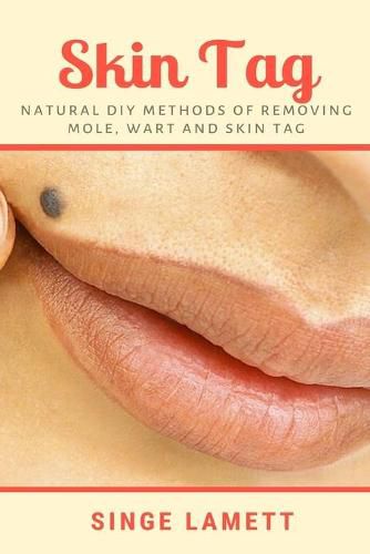 Cover image for Skin Tag: Natural DIY Methods of removing Mole, Wart and Skin Tag