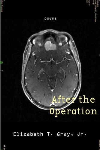 Cover image for After the Operation