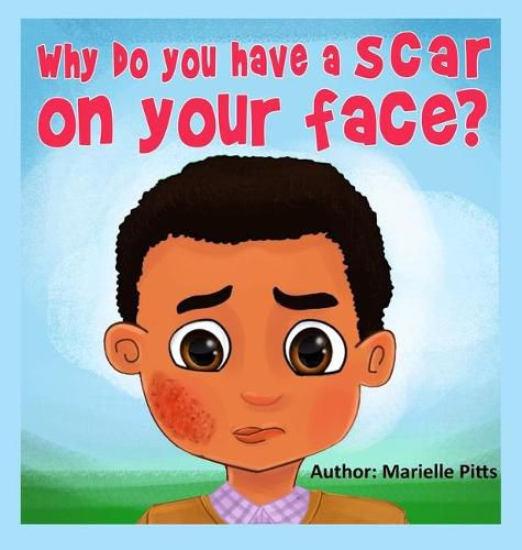 Cover image for Why do you have a scar on your face?